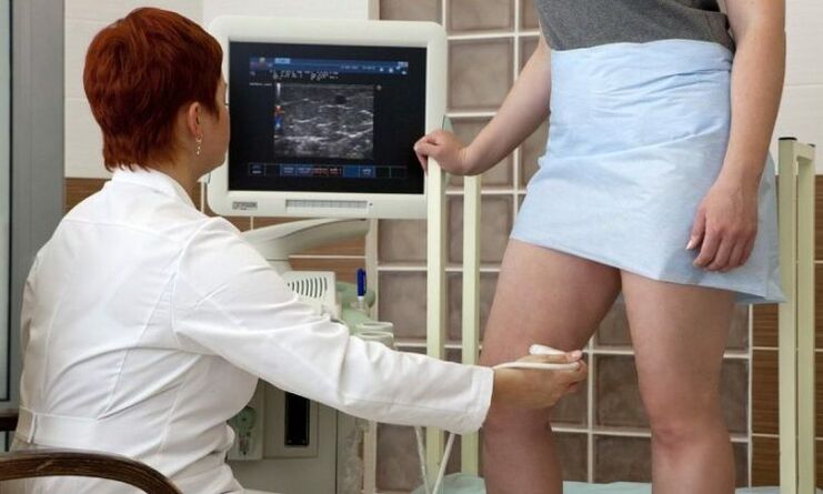 Λάστατορξη για τη θεραπεία των κιρσών φλεβών