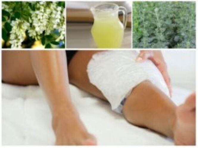 Μια πολύ αποτελεσματική λαϊκή μέθοδος για τη θεραπεία των κιρσών είναι η χρήση κομπρέσων.